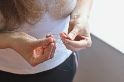 Woman holding bunch of fallen hair. Hair loss concept or Trichotillomania(human impulse behavioral problem,hair pulling disorder